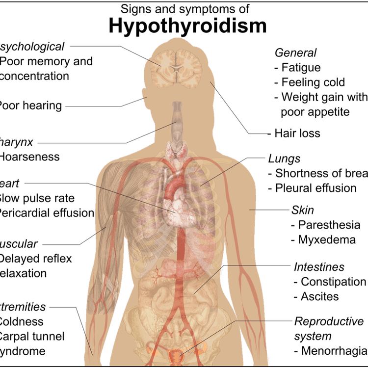 Hypothyroidism Medication, Hypothyroidism Medications Coupons, First