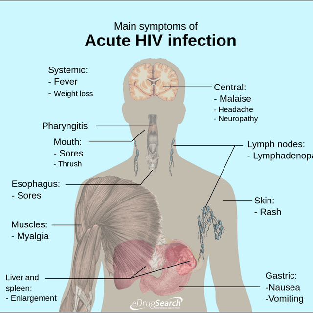 AIDS and HIV Medication, AIDS and HIV Medications Coupons